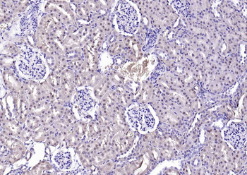 Fumarase/FH Mouse Monoclonal Antibody