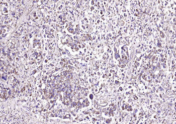 Fumarase/FH Mouse Monoclonal Antibody