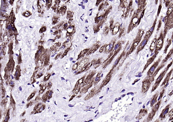 Fumarase/FH Mouse Monoclonal Antibody