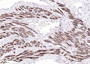 Fumarase/FH Mouse Monoclonal Antibody