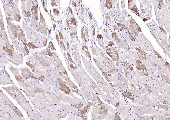 Fumarase/FH Mouse Monoclonal Antibody