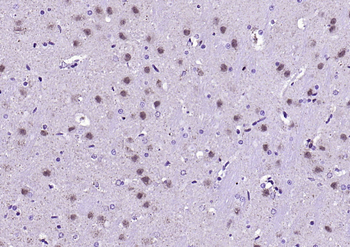 Fumarase/FH Mouse Monoclonal Antibody
