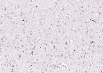 Fumarase/FH Mouse Monoclonal Antibody