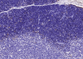 Cathepsin L Rabbit Polyclonal Antibody