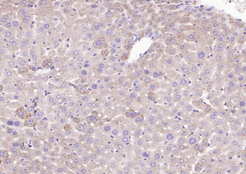 Cathepsin L Rabbit Polyclonal Antibody