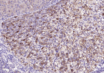 Cathepsin L Rabbit Polyclonal Antibody