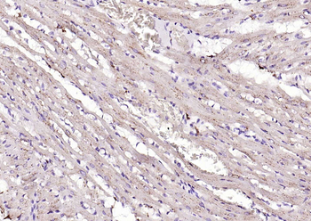 Cathepsin L Rabbit Polyclonal Antibody