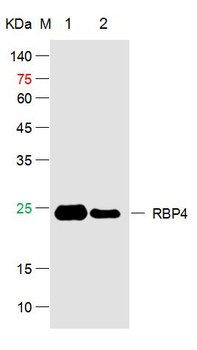 RBP4 Rabbit Polyclonal Antibody