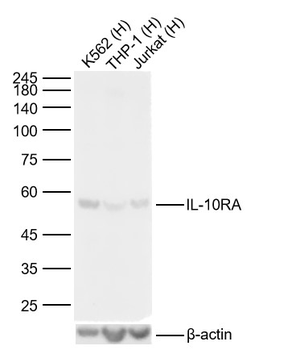 IL-10RA Rabbit Polyclonal Antibody