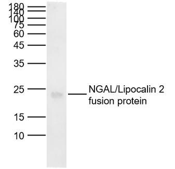 LCN2 Mouse Monoclonal Antibody