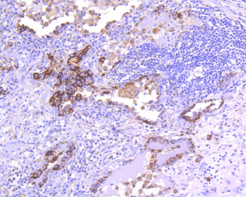 CD63 Recombinant Rabbit Monoclonal Antibody