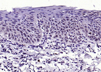 FGFR1 Rabbit Polyclonal Antibody