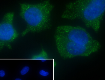 CD13 Recombinant Rabbit Monoclonal Antibody