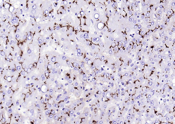 CD13 Recombinant Rabbit Monoclonal Antibody