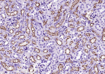 CD13 Recombinant Rabbit Monoclonal Antibody