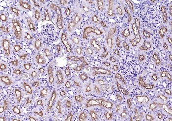 CD13 Recombinant Rabbit Monoclonal Antibody