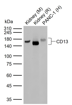 CD13 Recombinant Rabbit Monoclonal Antibody