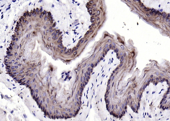 Keratin 6 Recombinant Rabbit Monoclonal Antibody