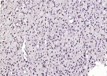 SPHK2 Mouse Monoclonal Antibody