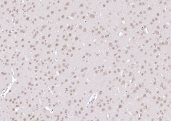 SPHK2 Mouse Monoclonal Antibody