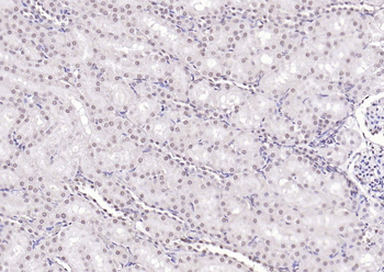 SPHK2 Mouse Monoclonal Antibody