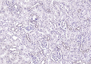SPHK2 Mouse Monoclonal Antibody