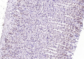 SPHK2 Mouse Monoclonal Antibody