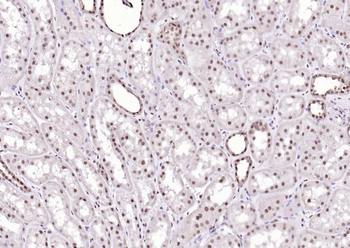 SPHK2 Mouse Monoclonal Antibody