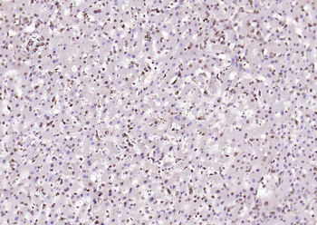 SPHK2 Mouse Monoclonal Antibody