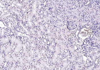 SPHK2 Mouse Monoclonal Antibody