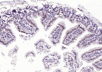 SPHK2 Mouse Monoclonal Antibody