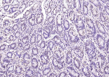 SPHK2 Mouse Monoclonal Antibody