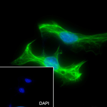 Desmin Recombinant Rabbit Monoclonal Antibody
