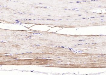 Desmin Recombinant Rabbit Monoclonal Antibody