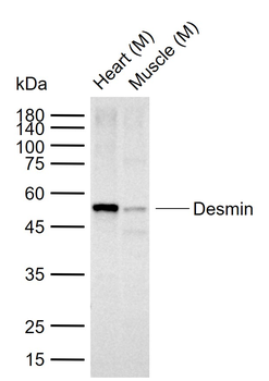 Desmin Recombinant Rabbit Monoclonal Antibody