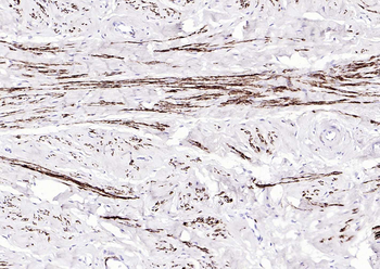 Desmin Recombinant Rabbit Monoclonal Antibody