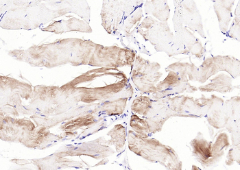 Desmin Recombinant Rabbit Monoclonal Antibody