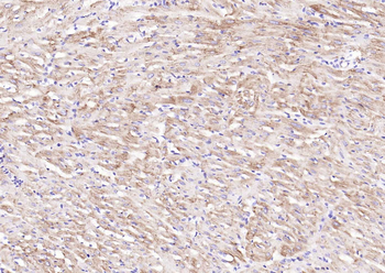 Desmin Recombinant Rabbit Monoclonal Antibody