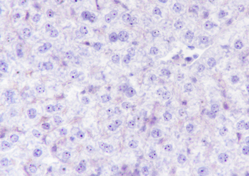 Nucleophosmin Recombinant Rabbit Monoclonal Antibody