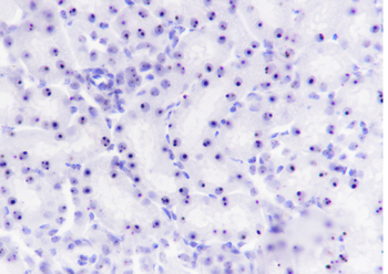 Nucleophosmin Recombinant Rabbit Monoclonal Antibody