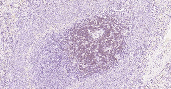 CD3E Recombinant Rabbit Monoclonal Antibody