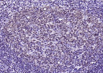 PAX5 Recombinant Rabbit Monoclonal Antibody