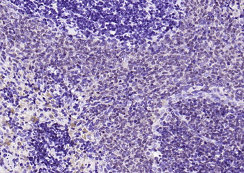 PAX5 Recombinant Rabbit Monoclonal Antibody