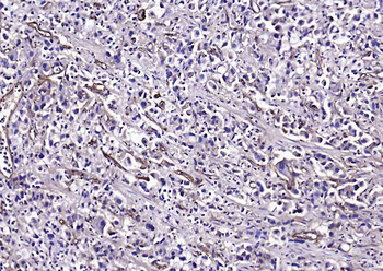 CD59 Recombinant Rabbit Monoclonal Antibody