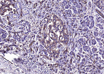 CD59 Recombinant Rabbit Monoclonal Antibody