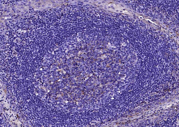 CD59 Recombinant Rabbit Monoclonal Antibody