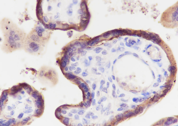 CD59 Recombinant Rabbit Monoclonal Antibody