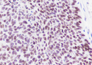 EZH2 Recombinant Rabbit Monoclonal Antibody