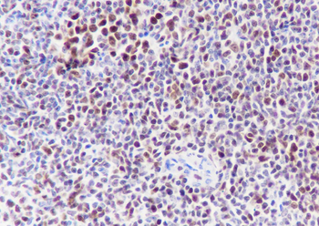 EZH2 Recombinant Rabbit Monoclonal Antibody