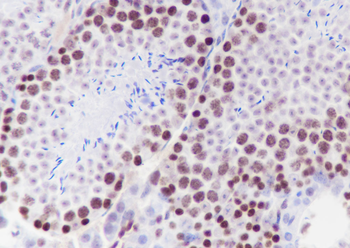 EZH2 Recombinant Rabbit Monoclonal Antibody